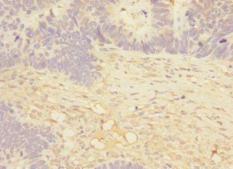 MAP4K5 Antibody