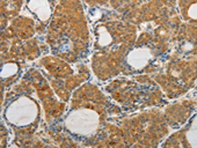 MAP4K5 Antibody