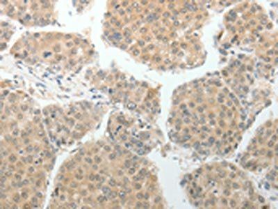 MAP4K5 Antibody