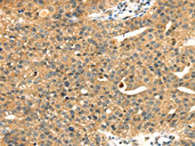 MAPK12 Antibody