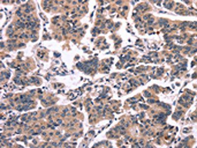 MAPK13 Antibody