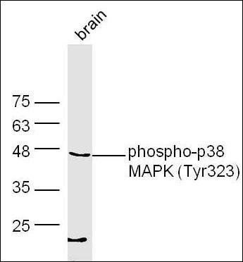 MAPK14 (phospho-Tyr323) antibody