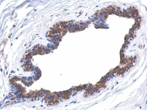 MAPK4 Rabbit Polyclonal Antibody