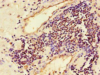 MAPK8 Antibody