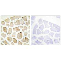 MAPKAPK3 Antibody