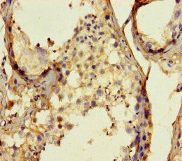 MAPRE1 Antibody
