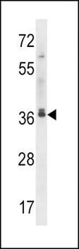 MAPRE2 antibody