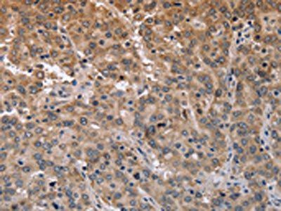 MAPRE3 Antibody