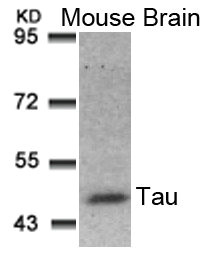MAPT (Ab-181) antibody