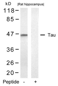 MAPT (Ab-422) antibody
