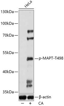 MAPT (Phospho-T498) antibody