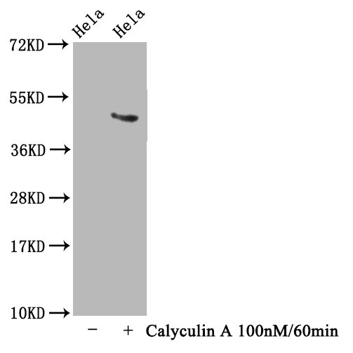 MAPT (Phospho-T231) antibody