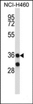 MARCH11 antibody