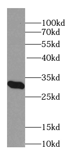 MARCH5 antibody