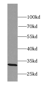 MARCH8 antibody