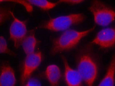 MARCKS (Ab-158) Antibody