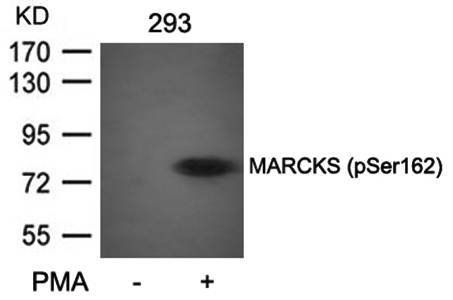 MARCKS (Phospho-Ser162) Antibody