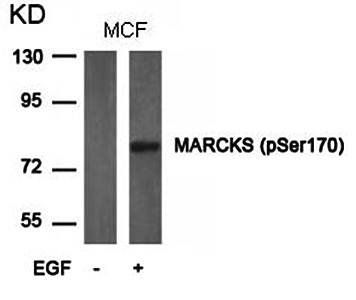 MARCKS (phospho-Ser170) Antibody