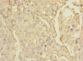 MARCO Antibody