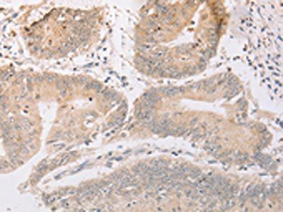 MARK1 Antibody