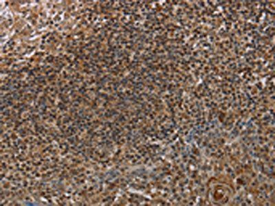 MARK1 Antibody