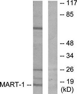 MART-1 antibody
