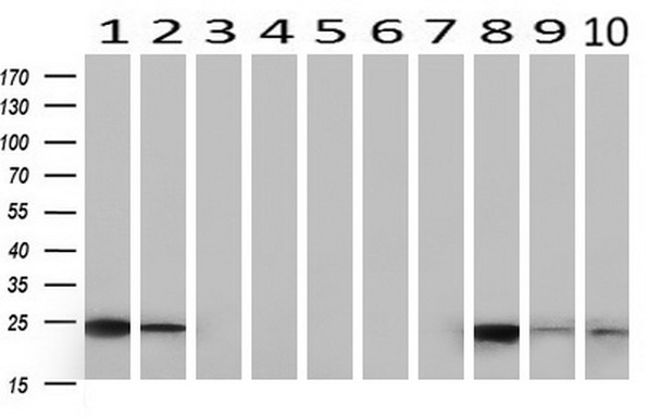 MASA (ENOPH1) antibody