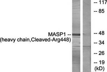 MASP1 (H chain, Cleaved-Arg448) antibody