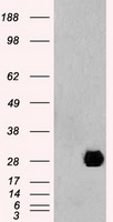 MASP2 antibody
