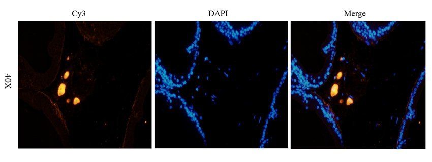 MASP2 antibody