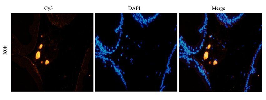 MASP2 antibody