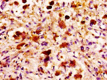 MASP2 Antibody