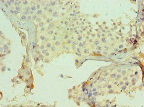 Mast Cell Chymase antibody