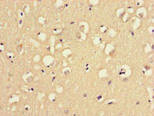MAST1 Antibody