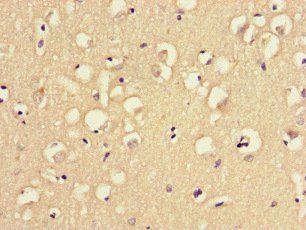 MAST1 antibody