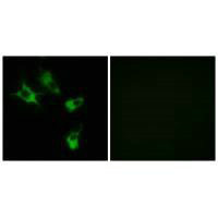MAST4 Antibody