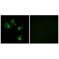 MAST4 antibody