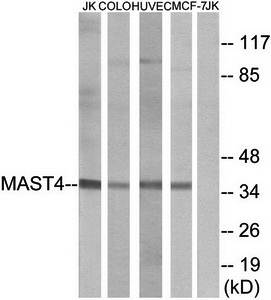 MAST4 Antibody
