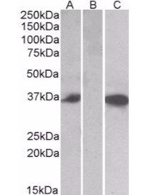 Mast Cell Chymase antibody