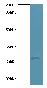 Mast Cell Chymase antibody