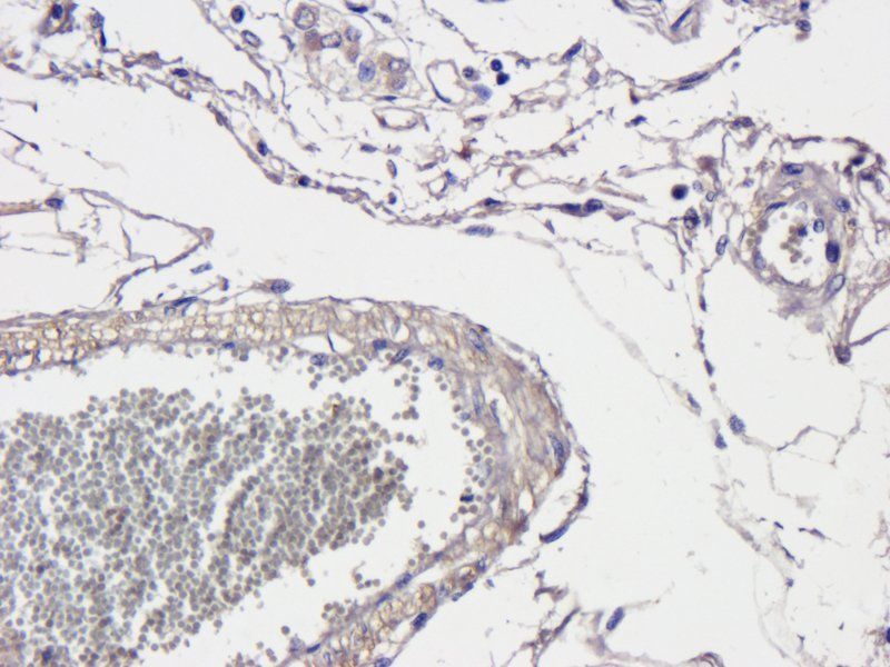 Mast Cell Chymase antibody