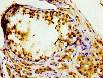 MASTL Antibody