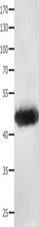 MAT1A Antibody