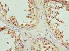 MAT2A Antibody