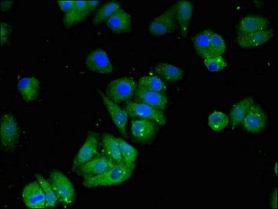 MAT2B antibody