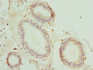 MATK Antibody