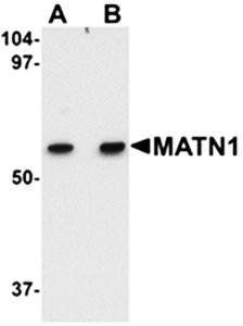 MATN1 Antibody