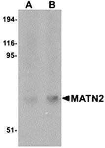 MATN2 Antibody