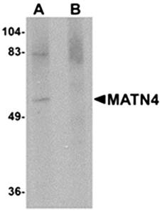 MATN4 Antibody
