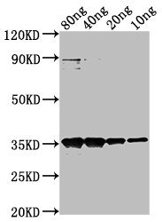 Matrix protein antibody